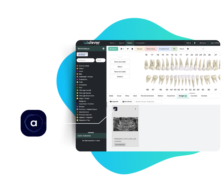 Intégration Allisone.ai à Weclever dental logiciel de gestion de cabiner dentaire