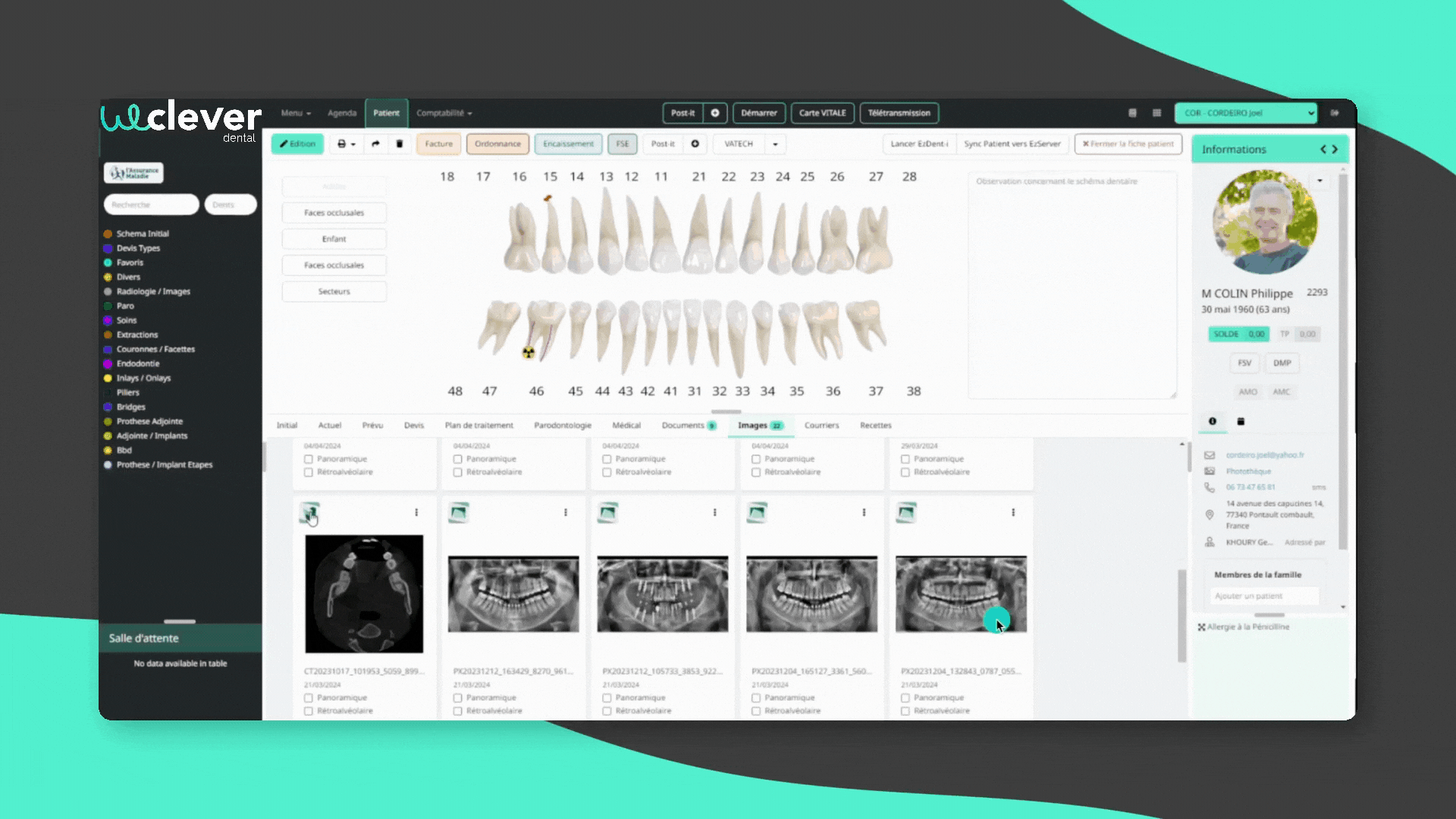 Vatech et weclever dental synchronisation automatique des clichés radiologiques de vos patients